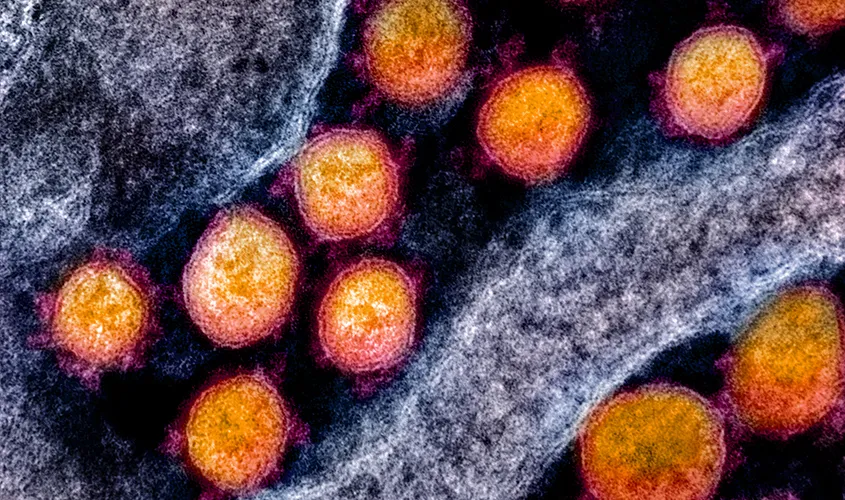 Colorized transmission electron micrograph (TEM) image of SARS-CoV-2 (COVID-19) virus particles, sourced from the CDC.